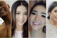 Sebelum vs Sesudah Veneer Gigi, 5 Artis ini Punya Senyum yang Beda Banget!