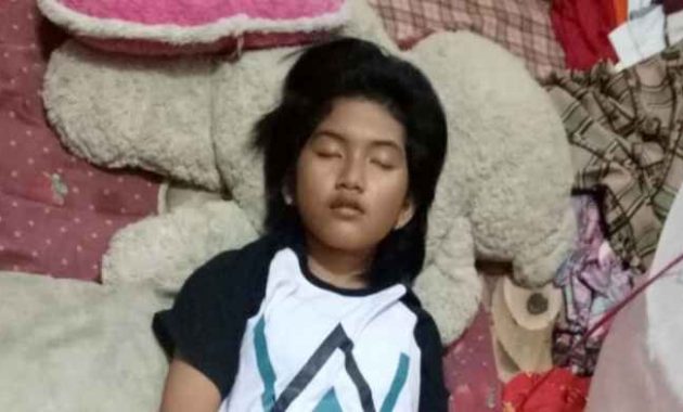 Waspada, Berikut 5 Kasus Sindrom Putri Tidur di Seluruh Dunia