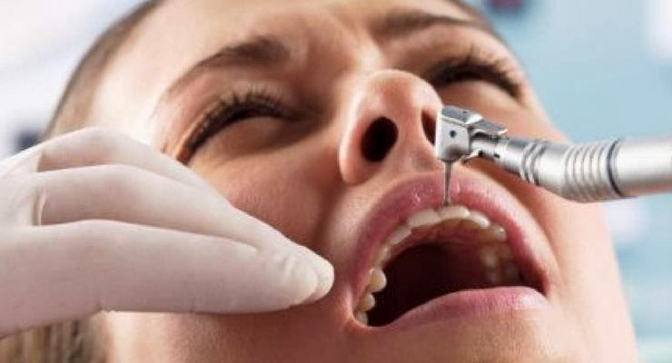 Ubat Sakit Gigi Bagi Ibu Hamil - Contoh Pustaka