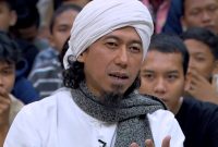 Alami Kecelakaan, Kaki Kanan Yukie Pas Band Patah