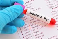 Penyebab Hepatitis A dan Cara Mencegahnya