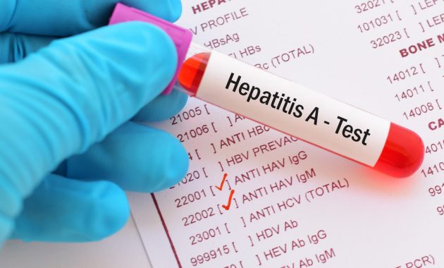 Penyebab Hepatitis A dan Cara Mencegahnya