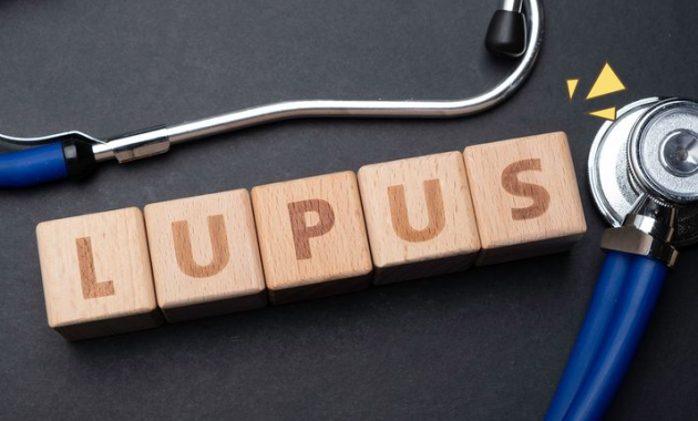 7 Gejala Penyakit Lupus pada Anak