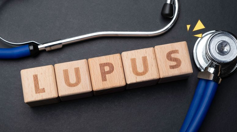 7 Gejala Penyakit Lupus pada Anak