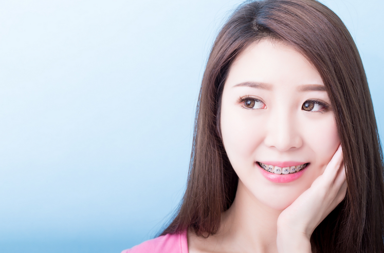 5 Dampak Akibat Perawatan Kawat Gigi yang Buruk