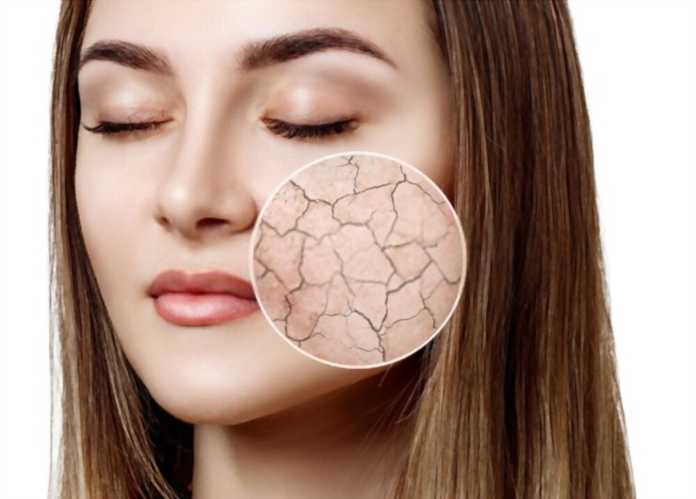 10 Tips Makeup untuk Pemilik Wajah Kering