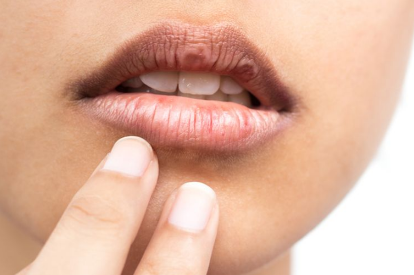5 Cara Agar Bibir Tidak Menghitam, Lebih Sehat dan Merona!