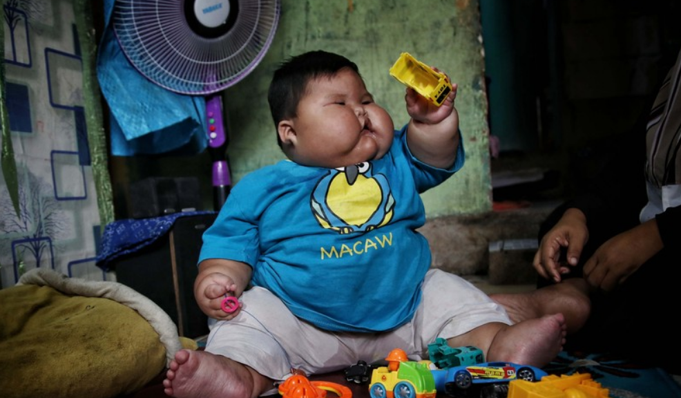 Bayi Usia 16 Bulan Berbobot 27 Kg, Ini yang Perlu Diingat Orangtua!