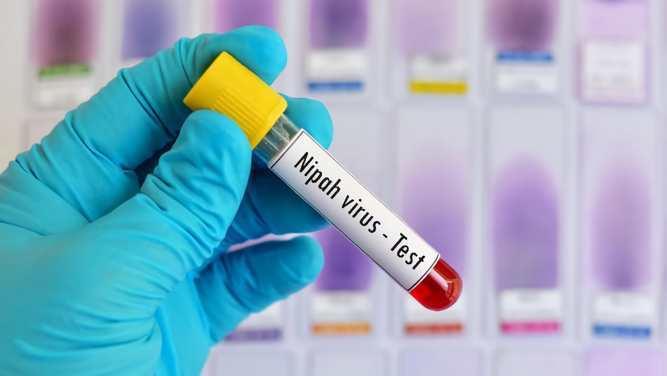 Virus Nipah: Pengertian, Gejala, dan Cara Mencegah