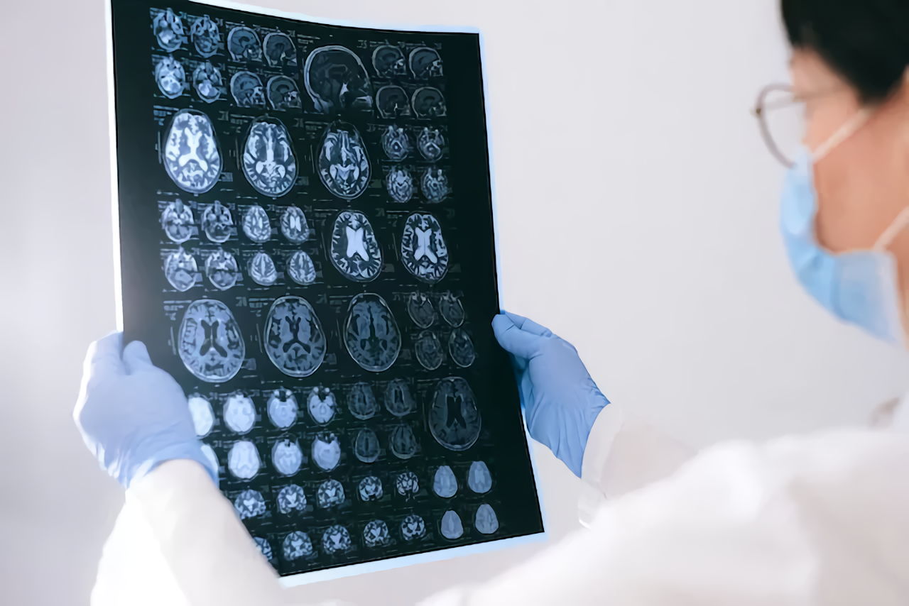 Kronologi Meninggalnya Anak 7 Tahun Usai Operasi Amandel Hingga Mati Batang Otak