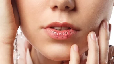 5 Kebiasaan yang Bikin Bibir Semakin Kering Selama Puasa, Harus Dihindari!